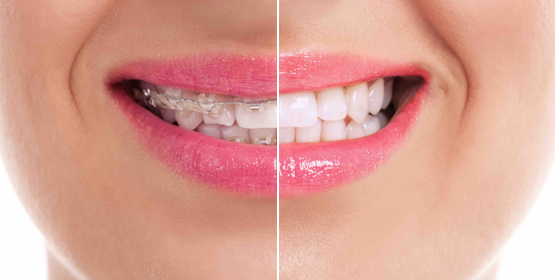 Liora Dental - Dr Seema Satish